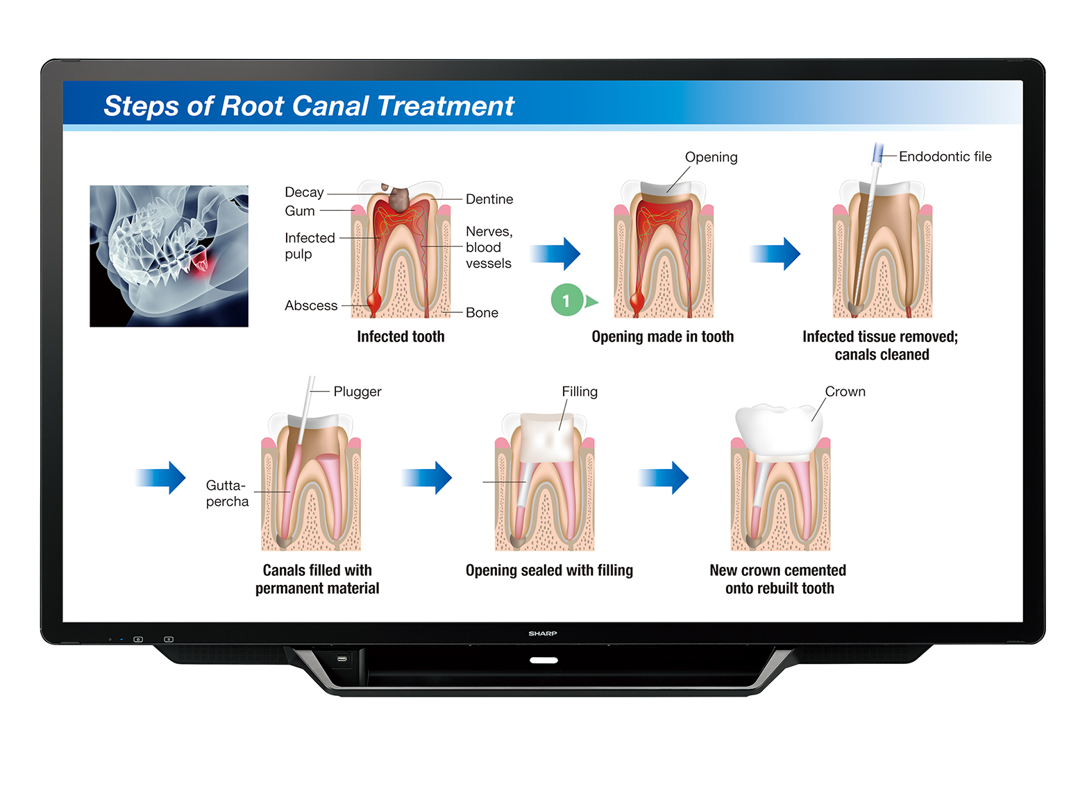PN-70TH5_dental_treatment